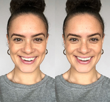 Beautiful Smiles Dental