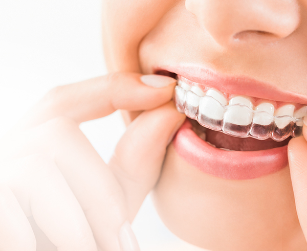 Beautiful Smiles Dental