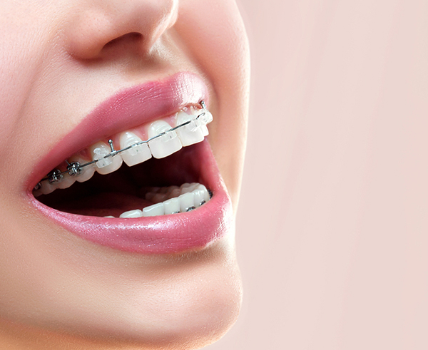 Beautiful Smiles Dental