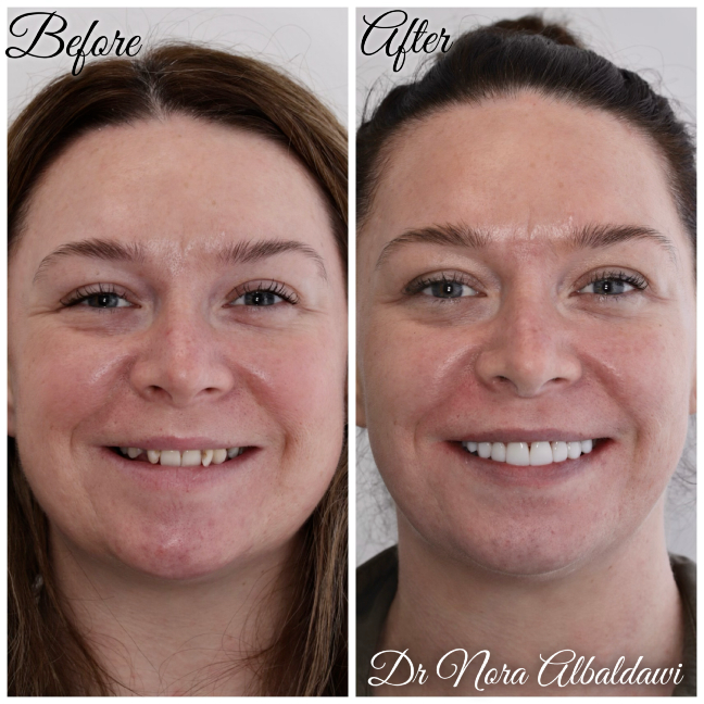 Gallery - Beautiful Smiles Dental