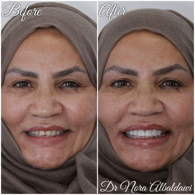 Gallery - Beautiful Smiles Dental